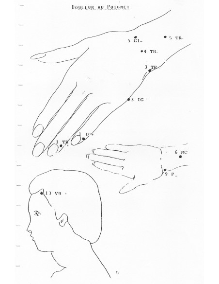 Digitopuncture et sport