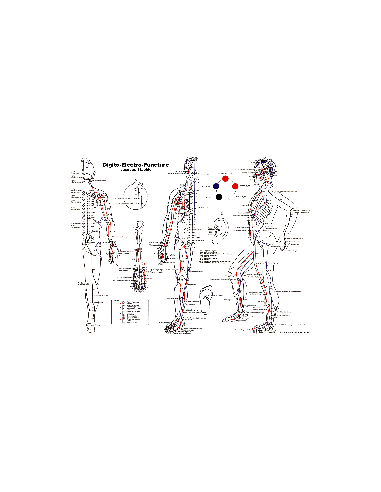 Poster carte des points digitopuncture